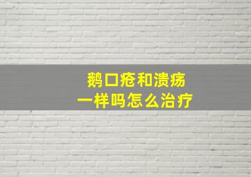 鹅口疮和溃疡一样吗怎么治疗