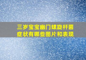 三岁宝宝幽门螺旋杆菌症状有哪些图片和表现