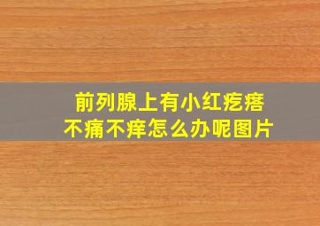 前列腺上有小红疙瘩不痛不痒怎么办呢图片