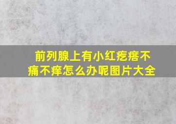 前列腺上有小红疙瘩不痛不痒怎么办呢图片大全