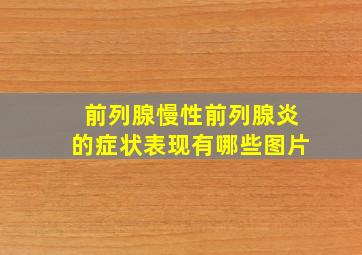 前列腺慢性前列腺炎的症状表现有哪些图片