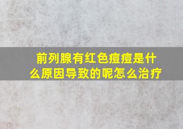 前列腺有红色痘痘是什么原因导致的呢怎么治疗