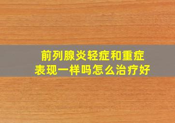 前列腺炎轻症和重症表现一样吗怎么治疗好