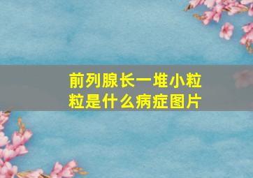 前列腺长一堆小粒粒是什么病症图片