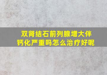 双肾结石前列腺增大伴钙化严重吗怎么治疗好呢