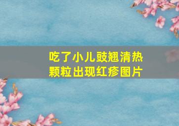 吃了小儿豉翘清热颗粒出现红疹图片