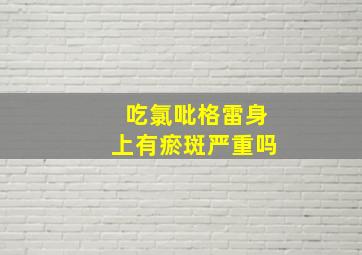 吃氯吡格雷身上有瘀斑严重吗