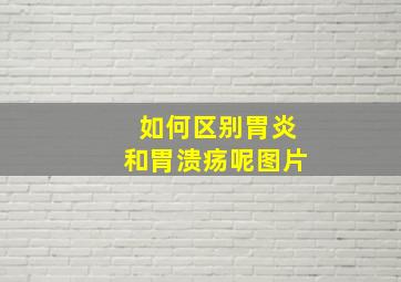 如何区别胃炎和胃溃疡呢图片