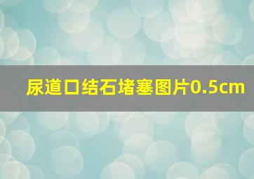 尿道口结石堵塞图片0.5cm