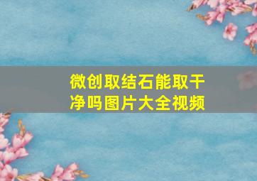 微创取结石能取干净吗图片大全视频