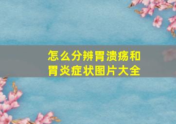 怎么分辨胃溃疡和胃炎症状图片大全