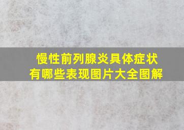 慢性前列腺炎具体症状有哪些表现图片大全图解