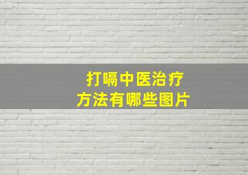 打嗝中医治疗方法有哪些图片