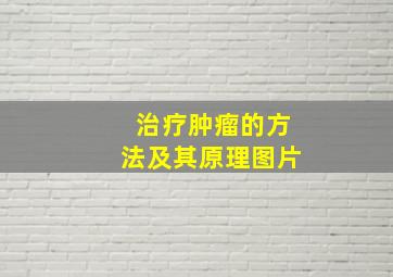 治疗肿瘤的方法及其原理图片