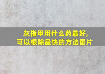 灰指甲用什么药最好,可以根除最快的方法图片