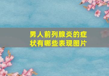 男人前列腺炎的症状有哪些表现图片