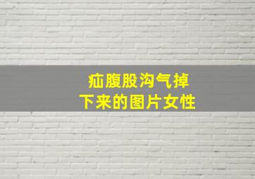 疝腹股沟气掉下来的图片女性