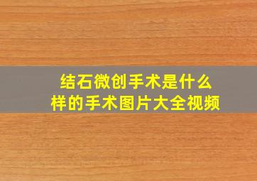 结石微创手术是什么样的手术图片大全视频