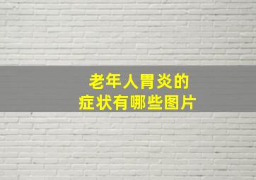 老年人胃炎的症状有哪些图片