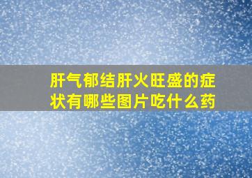 肝气郁结肝火旺盛的症状有哪些图片吃什么药