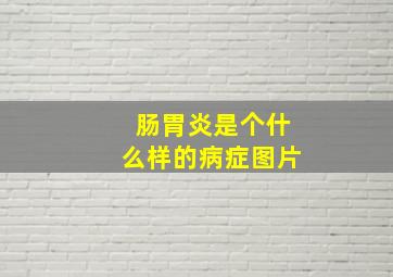 肠胃炎是个什么样的病症图片