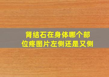 肾结石在身体哪个部位疼图片左侧还是又侧