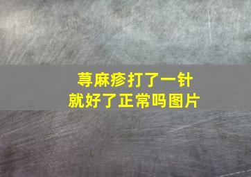 荨麻疹打了一针就好了正常吗图片