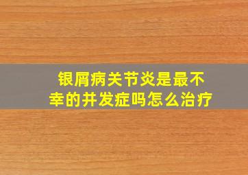 银屑病关节炎是最不幸的并发症吗怎么治疗