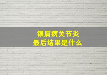 银屑病关节炎最后结果是什么