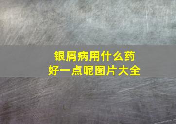 银屑病用什么药好一点呢图片大全