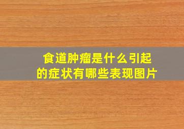 食道肿瘤是什么引起的症状有哪些表现图片